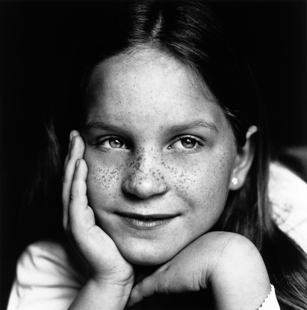 Close-up vom Mädchen mit Sommersprossen bei der Familienfotografie und Kinderfotografie mit Tageslicht in Hamburg Altona